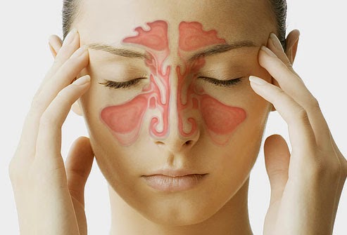 bệnh viêm xoang trong các bệnh tai mũi họng